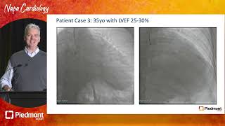 Appraisal of Successes and Shortfalls in CTO Revascularization [upl. by Oiramrej]