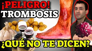 TROMBOSIS VENOSA SIGNOS DE ALARMA LOS MEJORES CONSEJOS PARA PREVENIR LA TROMBOSIS [upl. by Eissoj]