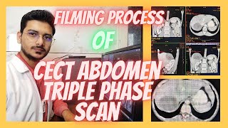 CT SCAN Abdomen Triple phase Filming process Triphasic abdominal Filming radiologytechnologist [upl. by Ahsaret452]