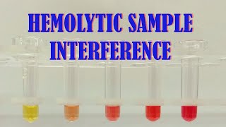 HEMOLYTIC SAMPLE INTERFERENCE [upl. by Bunnie357]