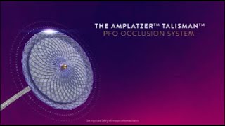 Amplatzer™ Talisman™ PFO Occlusion System Features [upl. by Cynthea]