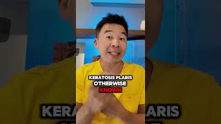 Treating Keratosis Pilaris [upl. by Alejandra]