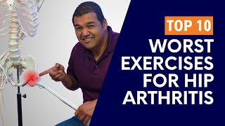 Top 10 Worst Exercises For Painful BoneOnBone Hip Arthritis [upl. by Llecrup716]