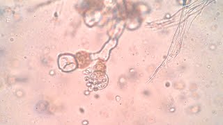 Sporangium of Pythium and Allomyces [upl. by Sayers640]