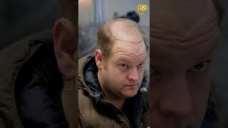 Now is the time amp Ers Clinic hairtransplant sacekimi [upl. by Arbma]