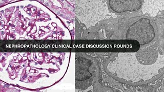 20240220 Nephropathology Clinical Case Discussion Rounds [upl. by Nnav]