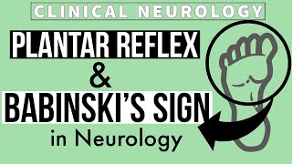 PLANTAR REFLEX  BABINSKIs SIGN  Equivocal Plantar  Other methods  Clinical Neurology [upl. by Damour]