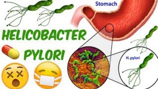 Hpyloricauses symptoms and diagnosis with treatment planh pylorinepalih pylori treatment [upl. by Atis]