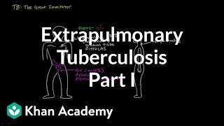 Extrapulmonary TB part 1  Infectious diseases  NCLEXRN  Khan Academy [upl. by Heinrick]