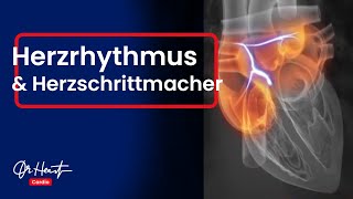 Herzrhythmusstörungen und Herzschrittmacher  Wer braucht ihn  Dr Heart [upl. by Puto]