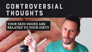 Controversial Thoughts Your skin issues are related to your diet [upl. by Hembree]