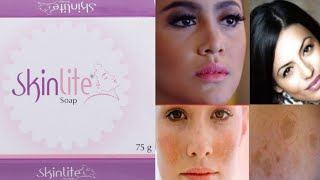 Skinlite Soap Review  Uses and Side Effects  कैसे यूज़ करे how to use skin light soap [upl. by Edia337]