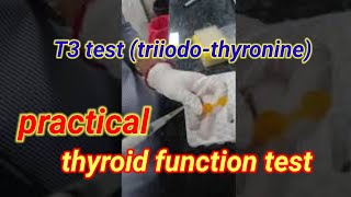 thyroid profile test in Hindi thyroid profile test kya hota hai  T3 triiodothyronine [upl. by Ennalorac446]