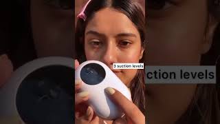 Get rid of Blackheads  Whiteheads With WINSTON Blackhead Remover [upl. by Notak17]