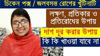 চিকেন পক্সজলবসন্ত রোগের লক্ষণ চিকিৎসা ও প্রতিরোধের উপায় All About Chicken Pox  Treatment amp Others [upl. by Eceela620]