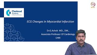 ECG changes in myocardial infarction [upl. by Isyed]