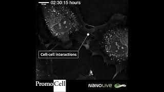 Protrusions in Human Umbilical Vein Endothelial Cells with Nanolive imaging [upl. by Ahsekal767]