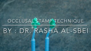 Occlusal Stamp Technique in 1 Minute  Clinical Case [upl. by Ameehsat416]