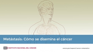 Metástasis Cómo se disemina el cáncer [upl. by Weidman]