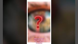 Peripheral Iridotomy In eye optocruisers eyecare optometry ophthalmology viral youtube [upl. by Edette]