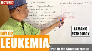 Hematology Lecture 7  Leukemia Day 02 [upl. by Adnarym]