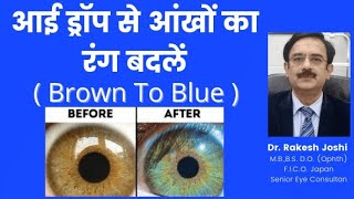 Eye color change by eye drops from brown to blue [upl. by Bobina]