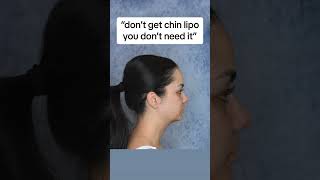 INSANE Chin Lipo RESULTS 😱🔥 chinlipo chinliposuction doublechin beforeandafter glowup [upl. by Henn354]