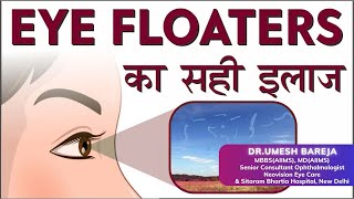 Eye Floaters  Cause amp Treatment  Risks amp Management of Floaters  Dr Umesh Bareja  Eye Specialist [upl. by Enneyehs]