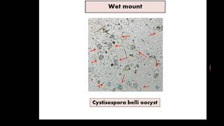 Stool Analysis 15 Cryptosporidium  Floatation  MZN الطفيليات الإنتهازية [upl. by Eisaj]