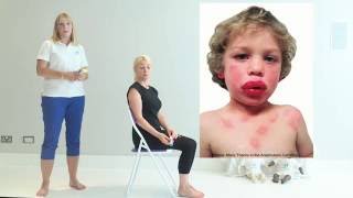 Top Tips for Anaphylaxis  First Aid [upl. by Yadrahs]