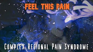 Complex Regional Pain Syndrome Feel This Pain S2E2 [upl. by Ednutey]