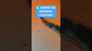 I VERMI dei BAMBINI gli OSSIURI prevenzione biologia [upl. by Aspasia]