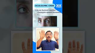 QuickLearningByte  OCULOGYRIC CRISIS  MEDICINE  DR RAHUL RAJEEV  DOCTUTORIALS [upl. by Gennaro]