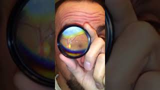 How to Do Your Own Fundus Exam [upl. by Ty369]