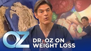 Dr Oz on Weight Loss  Oz Weight Loss [upl. by Decca]