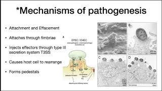 E coli infection in humans [upl. by Nob]