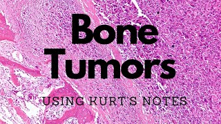 Bone Tumors Kurt’s Notes pathagonia [upl. by Bullough]