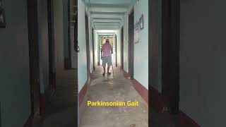 Parkinsonian Gait  Parkinsons Disease [upl. by Byers]