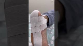 Kinesiology Taping for Plantar Fasciitis and Foot Pain doctor footfracture minivlog [upl. by Vod]