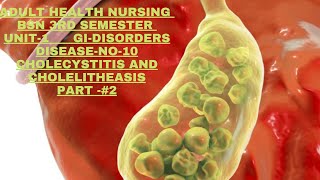 AdulHealthNursing BSN3rd semester Unitl GIDisorders Disease No10 Cholecystitis and cholelithiasis [upl. by Aitnwahs219]