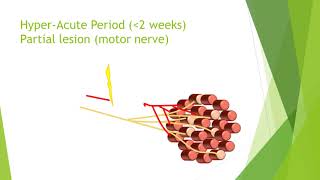 Nerve damage and repair [upl. by Refitsirhc]