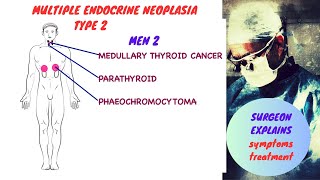 Multiple Endocrine Neoplasia  Type II MEN 2 [upl. by Hahnert]