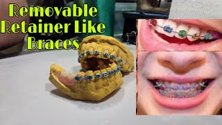 Retainer Like braces sa Pustiso Pustiso with braces na may Ngipin Dental Braces in The Philippines [upl. by Gnoy]