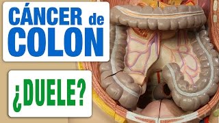 Cáncer de Colon y Dolor [upl. by Elrebmik]