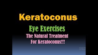 quotKERATOCONUS EYE EXERCISESquot That Really Work Keratoconus Natural Cure HD [upl. by Naihtniroc62]