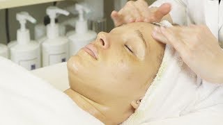 Skin Analysis amp How To Lighten Azures Melasma [upl. by Neelyar]