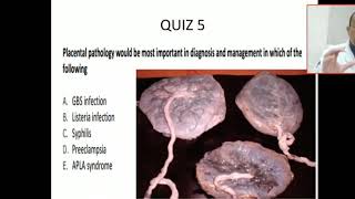 Case 6 how can placental examination help you for diagnosis and management Placental infections [upl. by Atekihs]