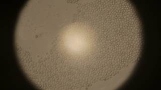 Yeast cells under the microscope [upl. by Elvyn]