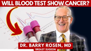 Will Blood Test Show Cancer  Dr Barry Rosen MD [upl. by Earized862]