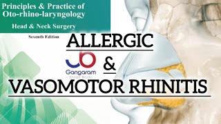 ALLERGIC amp VASOMOTOR RHINITIS CAUSES SYMPTOMS amp TREATMENT [upl. by Lynnet706]